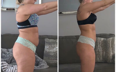 High Stress + Poor Gut Health = Chronic Dysfunction