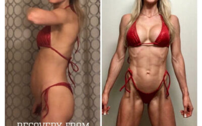 Post Competition Recovery: Stress Induced SIBO